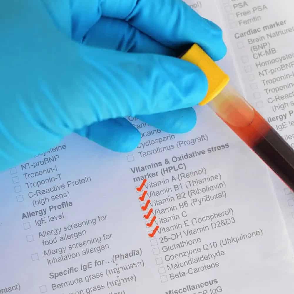 Private Blood Testing in West Berkshire – Fast, GP Oversight